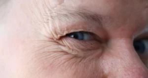 Skin Health